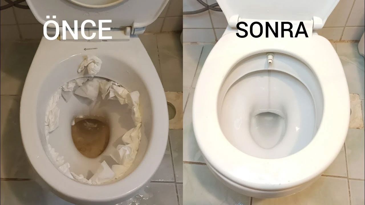 Klozetteki sarı lekeleri çıkaran yöntem! Evde kolayca uygulanıyor